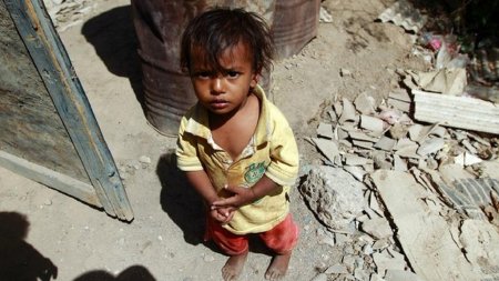В Йемене из-за голода и болезней каждый день умирает 130 детей