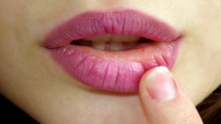 Учёные: Раны во рту заживают быстрей, чем порезы на теле