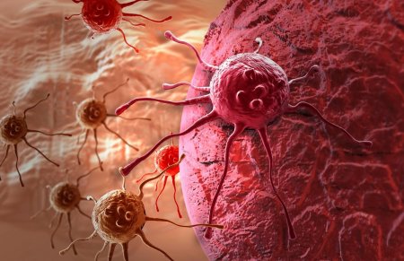 Ученые: Рак молочной железы провоцирует онкологию яичников
