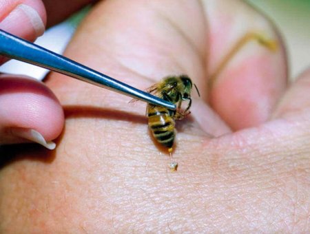 Красота требует жертв: Укусы пчёл способствуют похудению