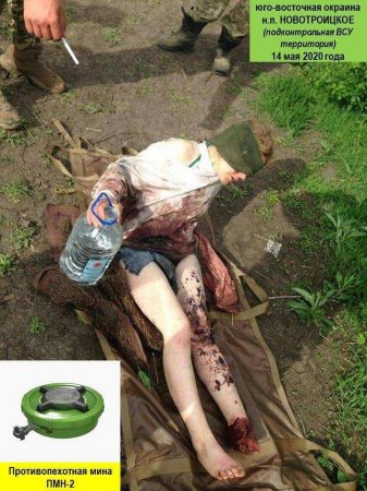 СРОЧНО: «ВСУшники» два часа издевались над мирной жительницей, потерявшей ногу на мине (ФОТО 18+)